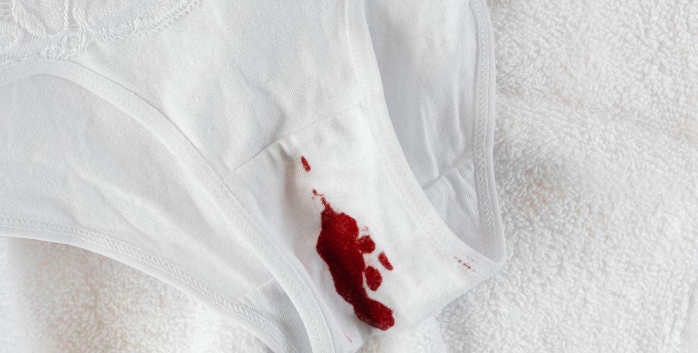 Histérico imperdonable portátil 6 tips para eliminar manchas de menstruación en tu ropa | Estilo Musa  Estilo De Vida